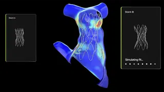 Heart of the Matter: How a Major Children’s Hospital Uses Open Source NVIDIA AI for Cardiac Care