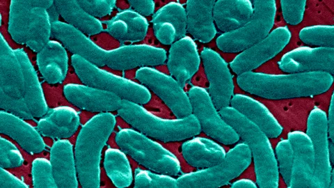 Flesh-eating bacteria devour man's arm and leg in just three days