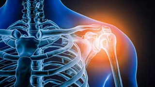 Doctors took a look at man's painful shoulder—they found the joint was missing
