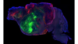 Researchers swap in human brain cells for a mouse's cortex