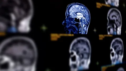 Tumors May Not Develop Randomly Across the Brain &mdash; Fruit Flies May Help Explain the Pattern