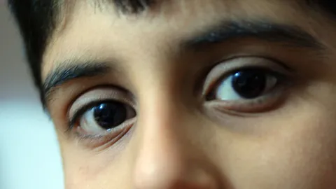  Diagnostic dilemma: Doctors couldn't explain why a boy was bleeding from his eyes, ears and nose 