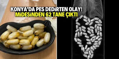 Konya'da pes dedirten olay: Midesinden 62 tane çıktı!