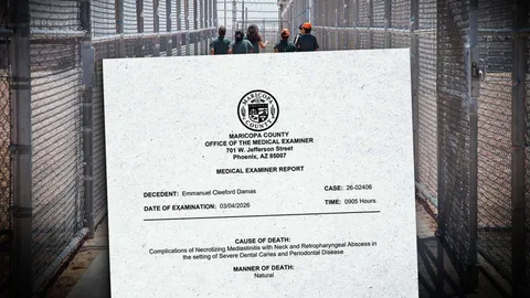 An ICE Detainee Died from a Tooth Infection, Autopsy Report Says