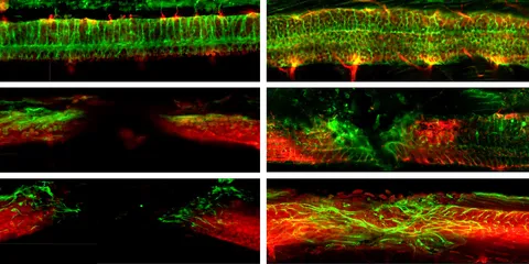 Microrobots deliver stem cells for nerve regeneration