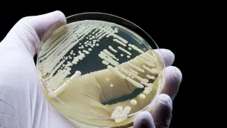 This Deadly Drug-Resistant Fungus Can Lurk in Your Skin. Scientists Just Discovered How
