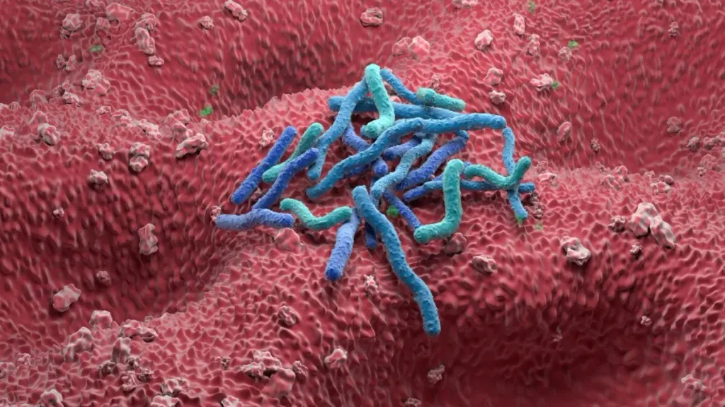 1 in 8 Cancers Are Caused by Infections. The Biggest Culprit Isn’t HPV