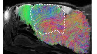 Scientists Grew More Human Brain Tissue in a Mouse Than Ever Before—and People Have Questions