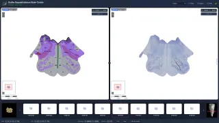 Best-Ever Brainstem Map Created by Indian Scientists