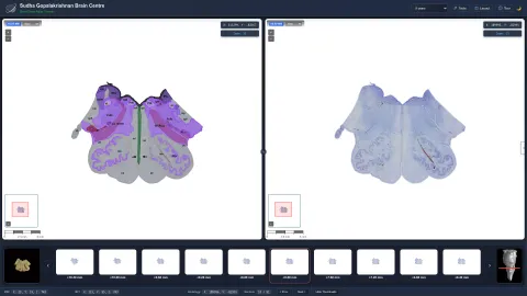 Best-Ever Brainstem Map Created by Indian Scientists