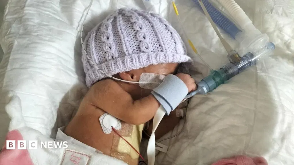 Delay to neonatal reform is putting babies at risk, warn doctors