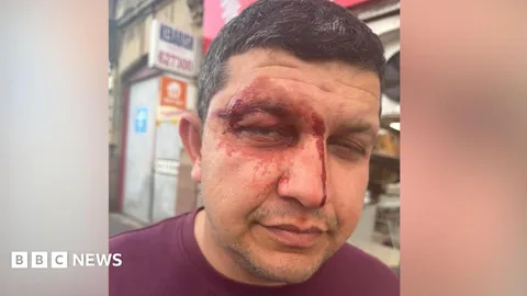 Gang of men hurl racist abuse at takeaway owner before violent attack