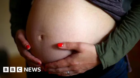 Over 100 maternity staff sue NHS over gas exposure