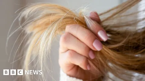 Emily nearly lost access to her baby because of a hair strand test. Experts fear she's not alone