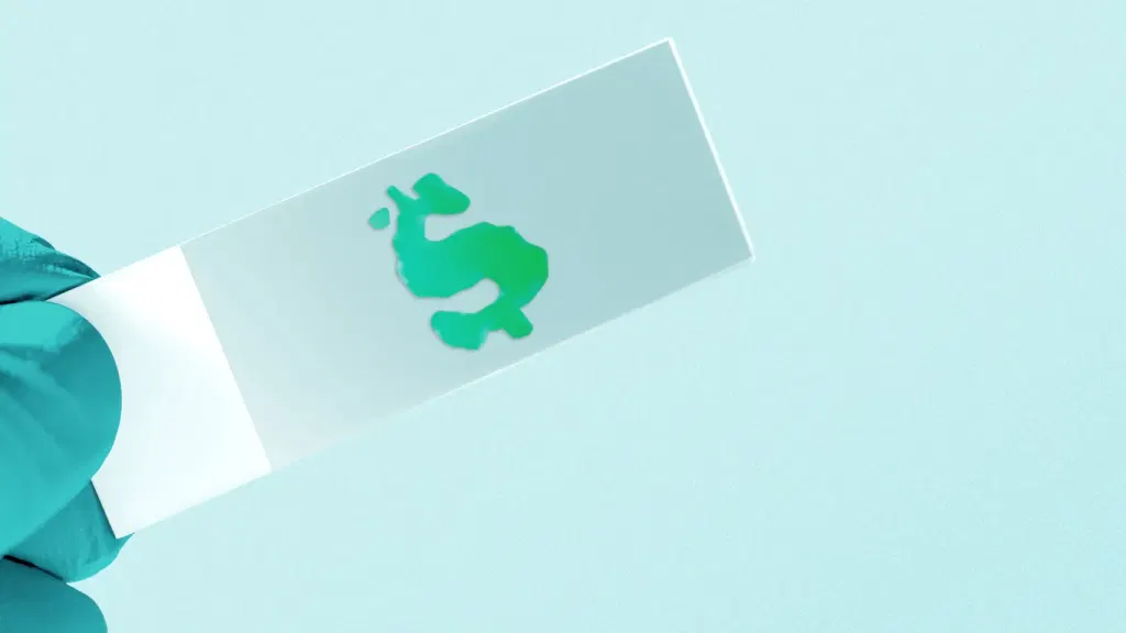 Ramona Optics, which makes microscopes that use AI to take and analyze large volumes of images of samples, raised a $25M Series A (Zachery Eanes/Axios)