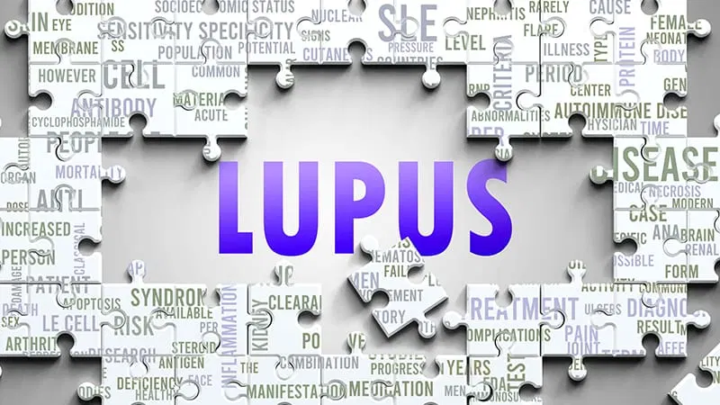 Belimumab Linked to Lower Relapse Risk in Lupus Serositis