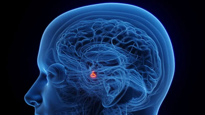Increased Mortality After Radiotherapy for Pituitary Adenoma