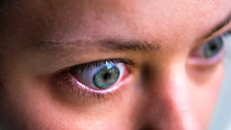 Phase 3: Rapid Relief in Thyroid Eye Disease With Veligrotug