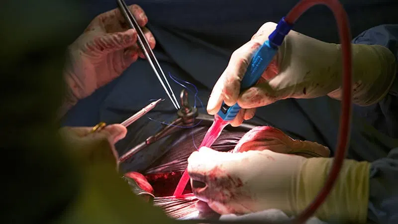 Indigenous-Led Study Targets Transplant Inequities
