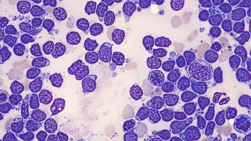 Venetoclax-Based Regimen Shows Promising Survival in Ph- ALL