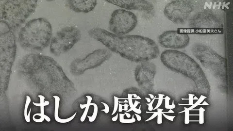 はしか感染者 ことし累計498人に 過去10年の最多に迫るペース