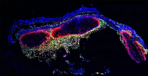 Watch Immune System Cells Gobble Up Cancer Cells