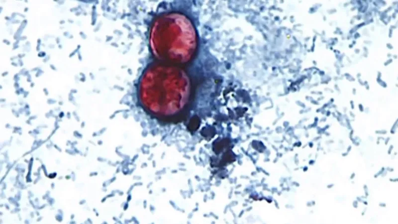 Questions grow over potential impact of budget cuts on response to cyclospora outbreak