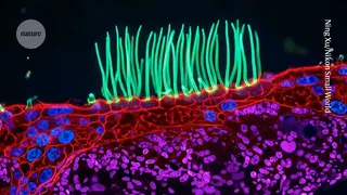 Award-winning microscopy image used AI