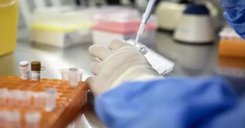 Supercharging Immune Cells May Help Control HIV Long-Term