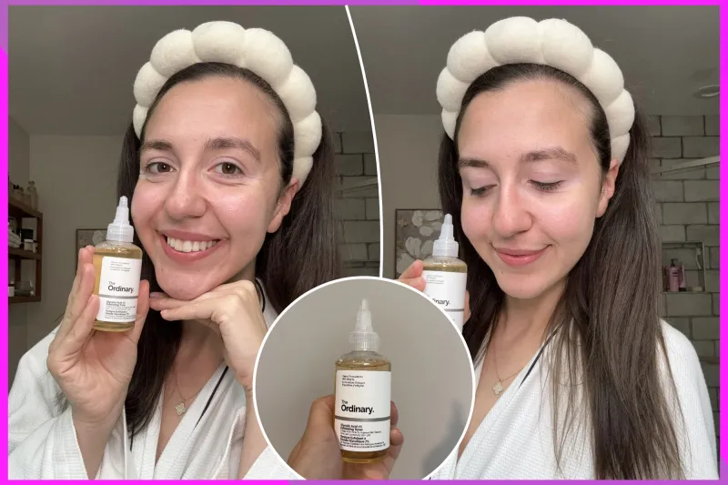 I tried The Ordinary’s $9 Glycolic Acid 7% Toner: Here’s how it improved my skin texture
