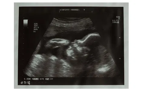 Louisiana rejects another effort to add rape, incest exceptions to abortion ban