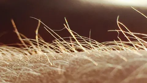 Itching May Have Its Own Sensory Organ