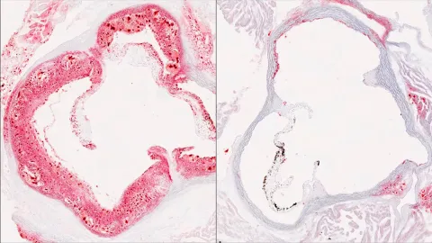 Scientists discover hidden liver switch that cuts harmful cholesterol