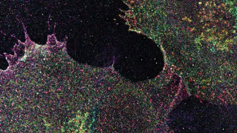Hidden sugar patterns on human cells could reveal cancer early