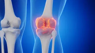 Stanford scientists found a way to regrow cartilage and stop arthritis