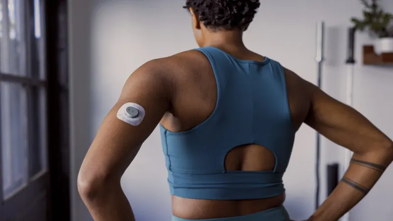 STAT+: Dexcom CEO hints at future uses for CGM
